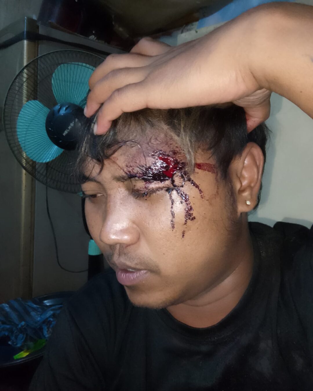 Kasus Penganiayaan Januar Memanas, LSM Gempar Jember Desak Penahanan Pelaku: Ini Atensi Kapolri!