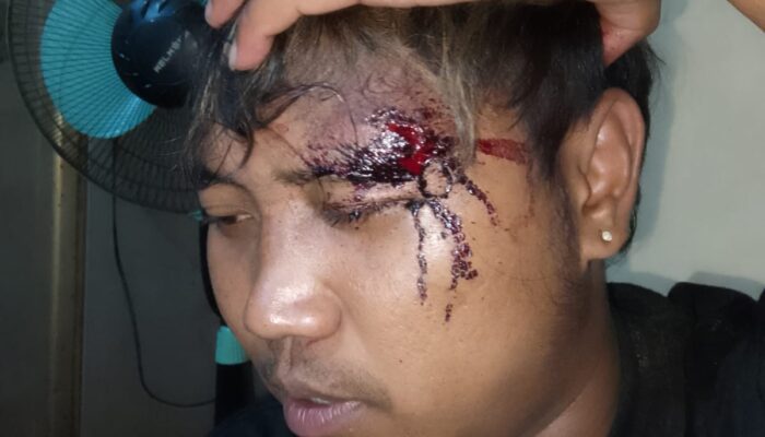 Kasus Penganiayaan Januar Memanas, LSM Gempar Jember Desak Penahanan Pelaku: Ini Atensi Kapolri!